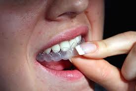 Care after tooth extractions and minor surgery